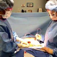 Photo Of Breast Reduction Surgery