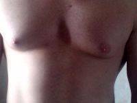 Denver Male Breast Reduction
