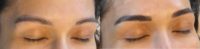 45-54 year old woman treated with Microblading